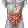 Colitis and Crohn's Disease